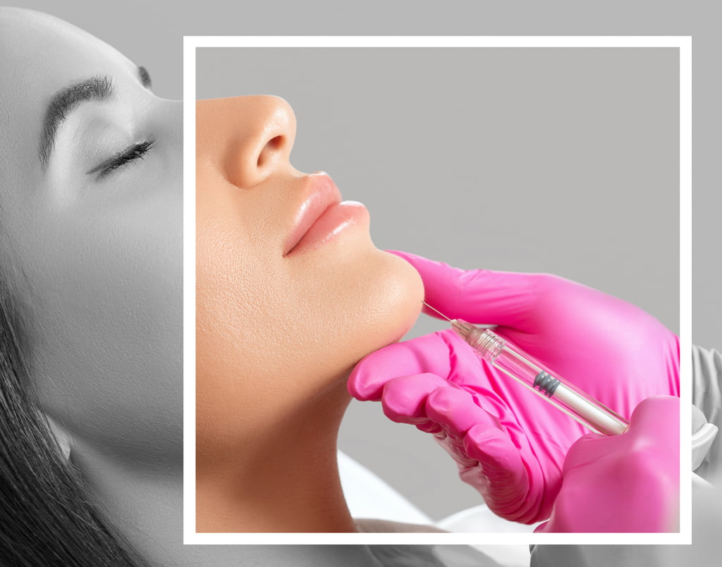 Çene ve Çene Hattı (Jawline) Dolgusu İstanbul Bahçeşehir Başakşehir